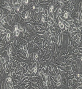 Hela-299人宫颈癌细胞主图