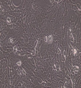 CFPAC-1人胰腺癌细胞主图