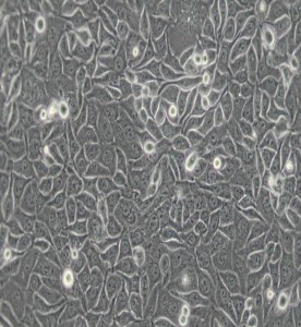 CNE-2Z人鼻咽癌细胞主图