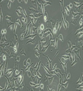 CNE人鼻咽癌细胞主图