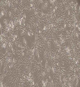 ES-2人卵巢透明细胞癌细胞主图