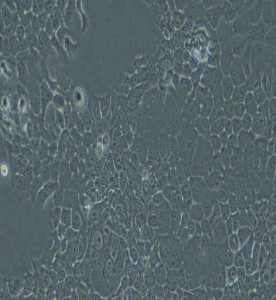 FaDu人咽鳞癌细胞主图