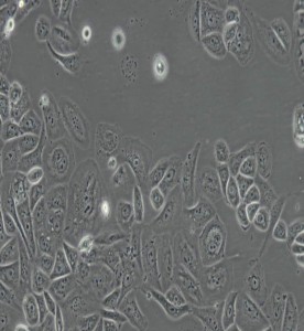 GBC-SD人胆囊癌细胞主图