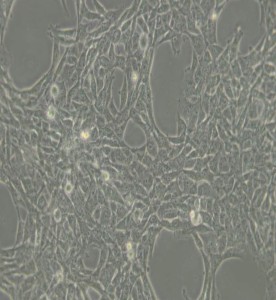 HBL-100人整合SV40基因的乳腺上皮细胞主图