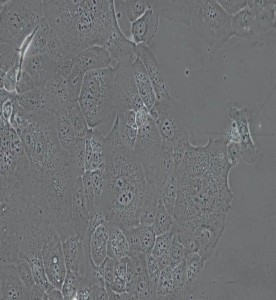HCC1937人乳腺癌细胞主图