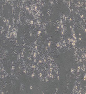 HCCC-9810人胆管细胞型肝癌细胞主图