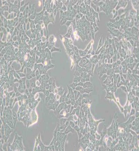 HCT-116人结肠癌细胞主图