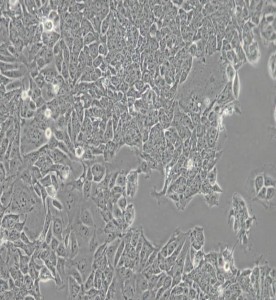 HCT-15人结直肠腺癌细胞主图