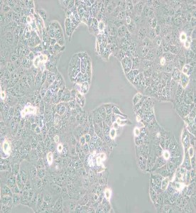 HEC-1-A人子宫内膜腺癌细胞主图