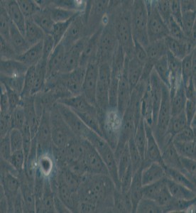HOS人骨肉瘤细胞主图