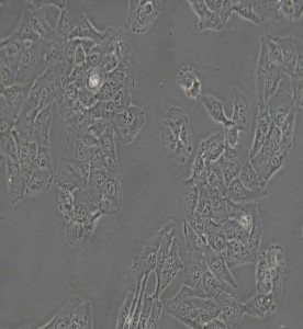 HT1080人纤维肉瘤细胞主图