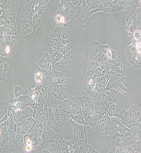 HT-1376人膀胱癌细胞主图