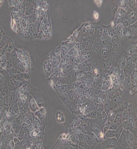 HuH-6人肝母细胞瘤细胞主图