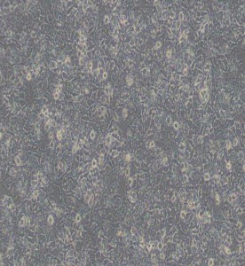 HuH-7人肝癌细胞主图