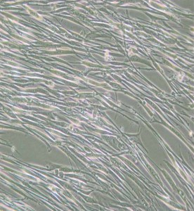 IMR-90人胚肺成纤维细胞主图