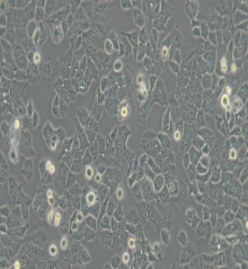 Ishikawa人子宫内膜癌细胞主图