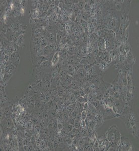 JAR人胎盘绒毛癌细胞主图