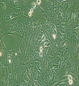 KMH-2人甲状腺癌细胞主图