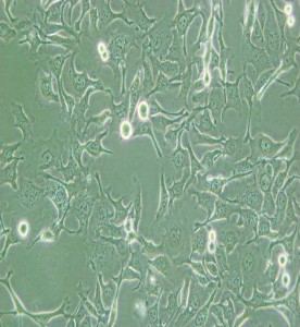 KYSE-410人食管鳞癌细胞主图