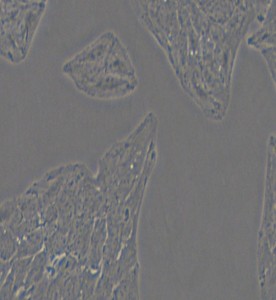 Li-7人肝癌细胞主图