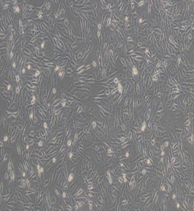 MDA-MB-231 人乳腺癌细胞(L15)主图