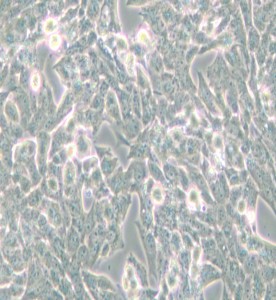 NCI-H295R人肾上腺皮质腺癌细胞主图