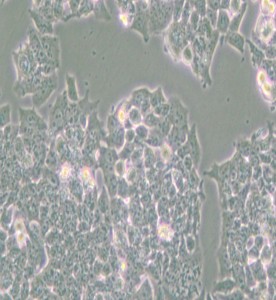 NCI-H520人肺鳞癌细胞主图
