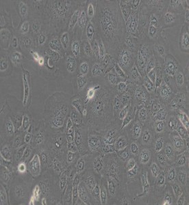 NCI-H1650人非小细胞肺癌细胞主图
