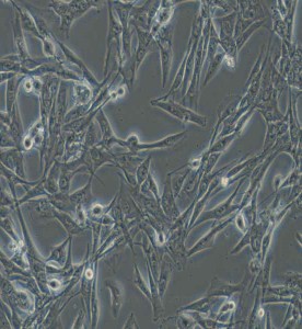 NCI-H1975人肺腺癌细胞主图