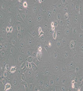 MARC-145非洲绿猴胚胎肾细胞主图