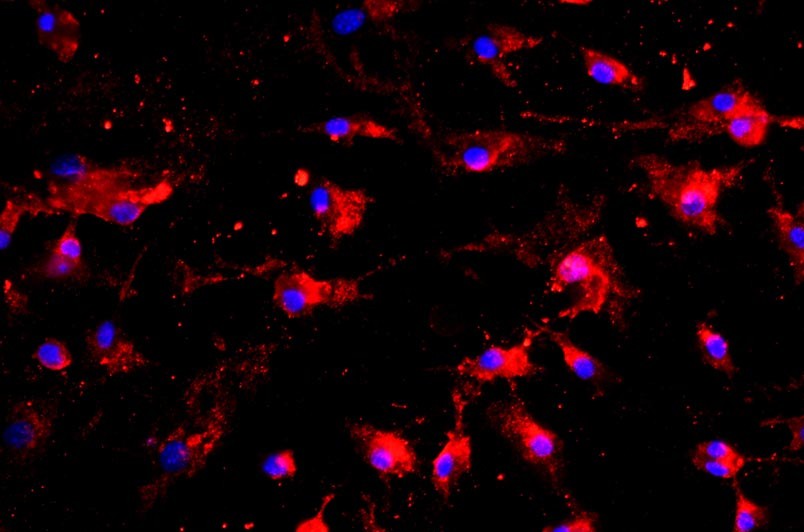 大鼠肺微血管内皮细胞主图
