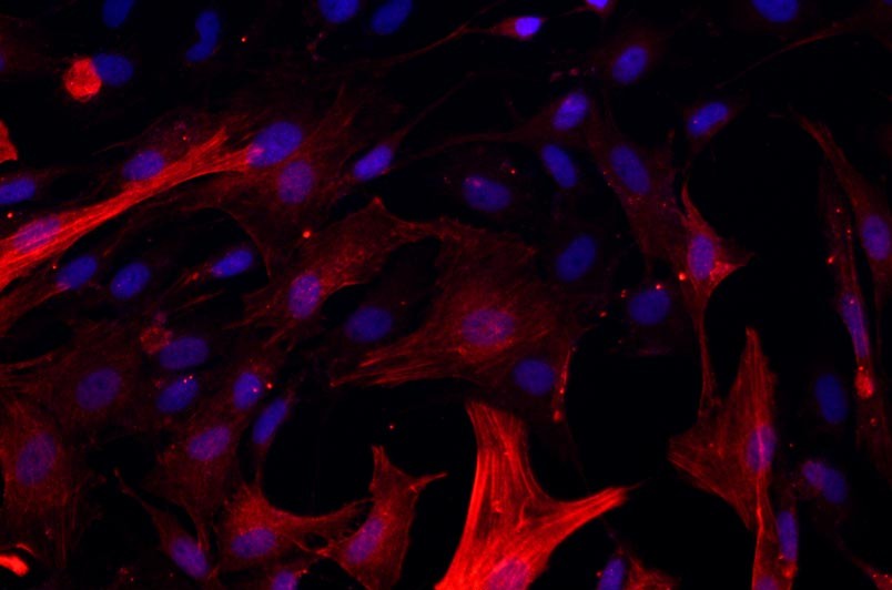 大鼠气管平滑肌细胞主图