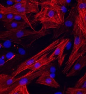 大鼠肺大动脉平滑肌细胞主图
