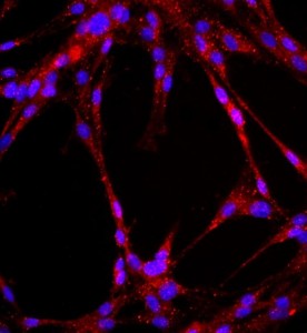 大鼠肺大动脉内皮细胞主图