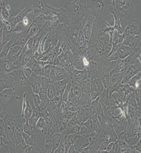 RBE人肝胆管癌细胞主图