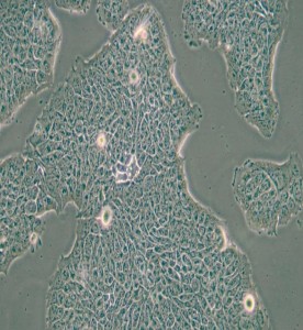 RT4人膀胱移行细胞乳头瘤细胞主图