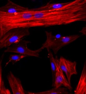 大鼠肝星状细胞主图