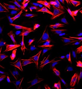 大鼠小肠平滑肌细胞主图