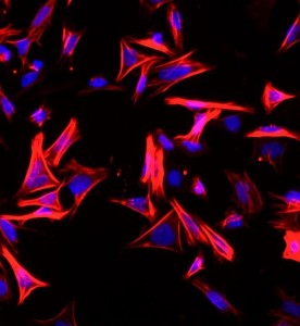 大鼠结肠平滑肌细胞主图