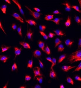 大鼠心肌成纤维细胞主图