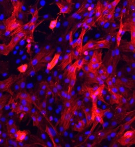 大鼠主动脉平滑肌细胞主图