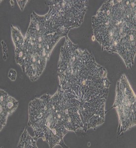 T84人结肠腺癌肺转移细胞主图