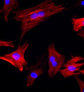 大鼠大隐静脉平滑肌细胞主图