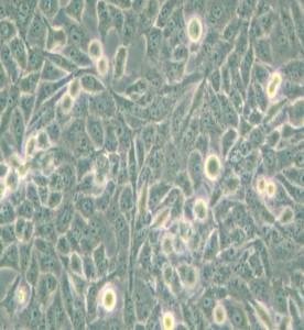 NCI-H157人非小细胞肺腺癌细胞主图