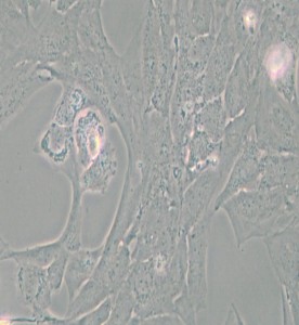 NCI-H196人小细胞肺癌细胞主图