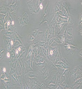 NCI-H1563人非小细胞肺癌细胞主图