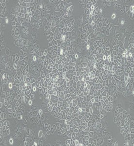 SW-13人肾上腺皮质小细胞癌细胞(L15)主图