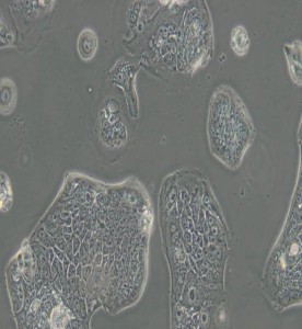 SW1116人结肠腺癌细胞(L15)主图