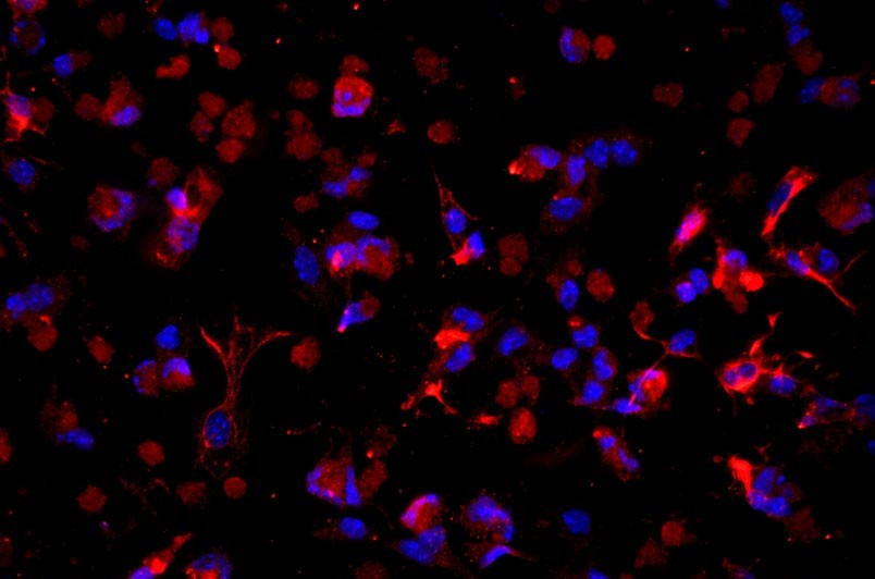 小鼠肝星状细胞主图