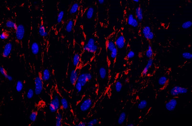 小鼠脑微血管内皮细胞主图